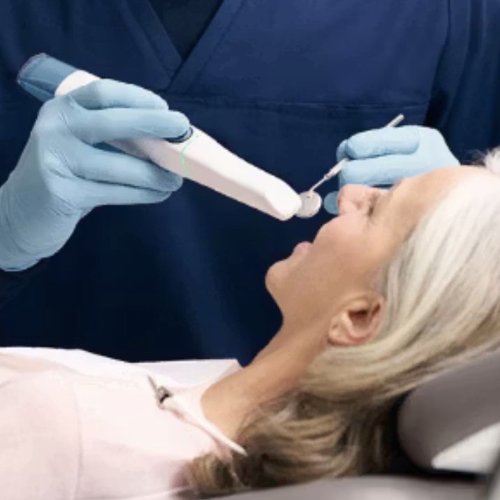 3D intra-oral scanner in use