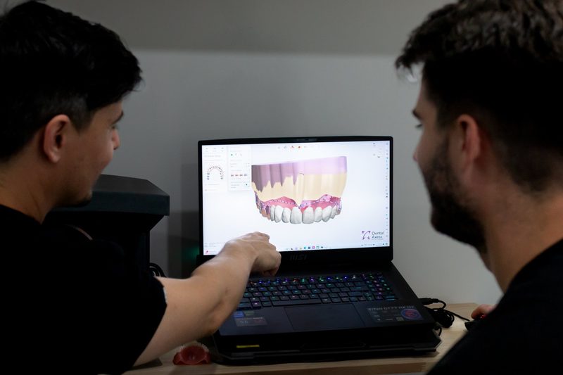 Digital denture design
